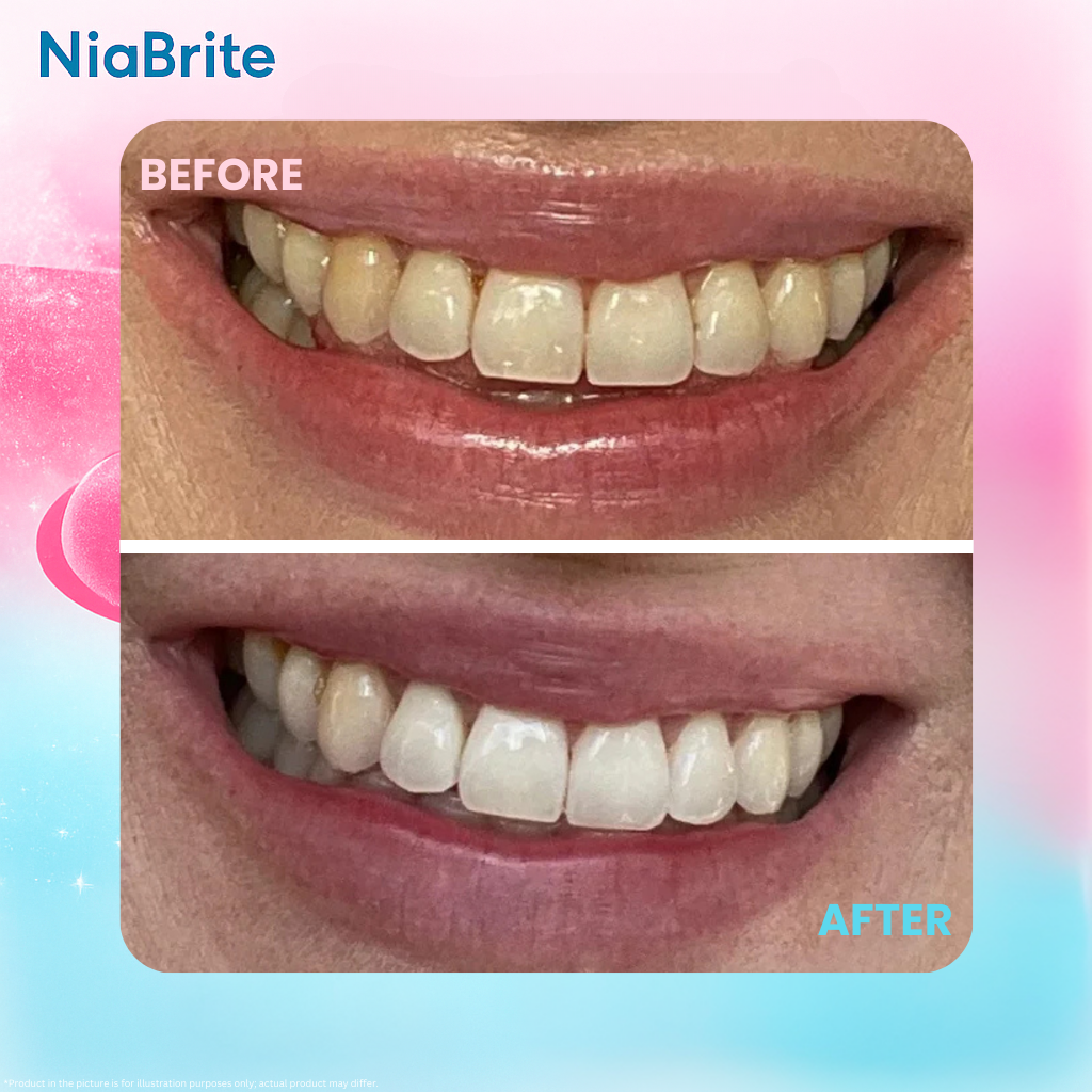 NiaBrite Niacinamide Whitening Toothpaste