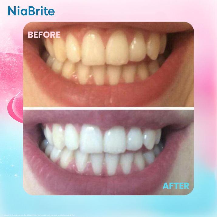 NiaBrite Niacinamide Whitening Toothpaste