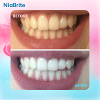 NiaBrite Niacinamide Whitening Toothpaste